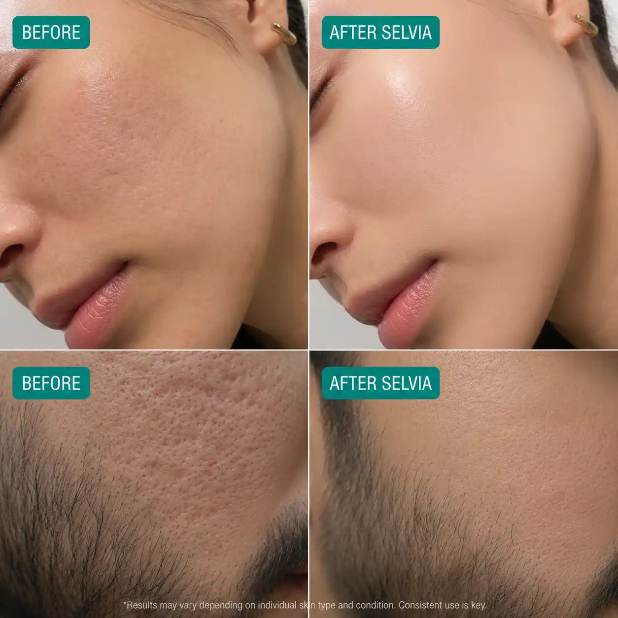 Microcrystal™ Serum PM Duo