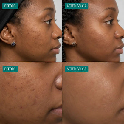 Microcrystal™ Serum PM Duo